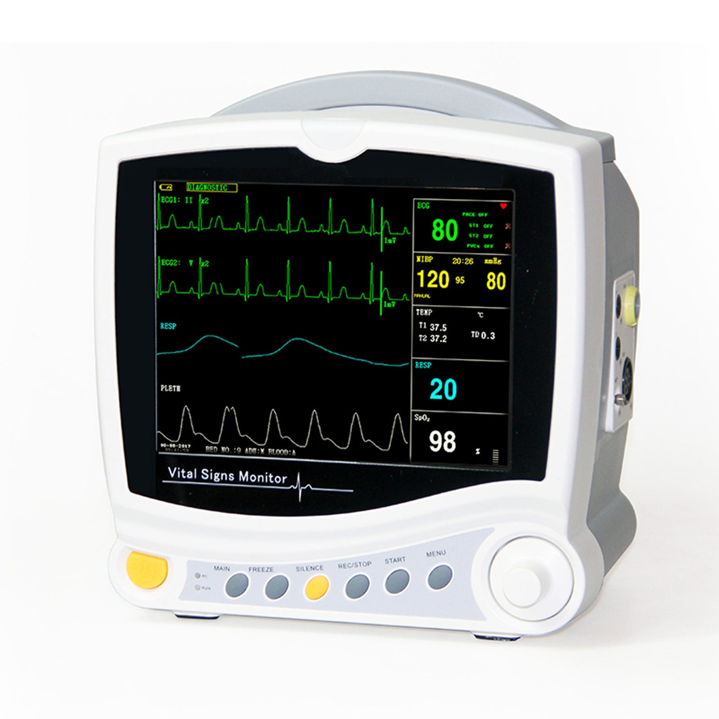 SR033 patient monitor 6 para ECG, RESP, SpO2, PR, NIBP,TEMP 8'' color TFT LCD