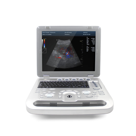 RR1700A Portable Color Doppler Ultrasound Scanner Machine+ Probe