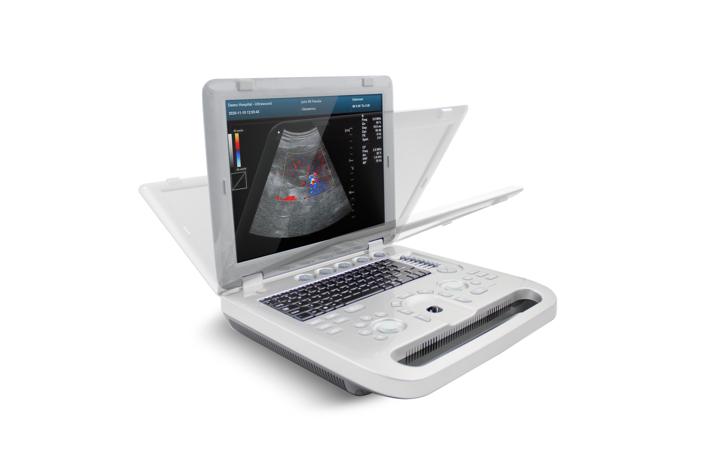 RR1700A Portable Color Doppler Ultrasound Scanner Machine+ Probe