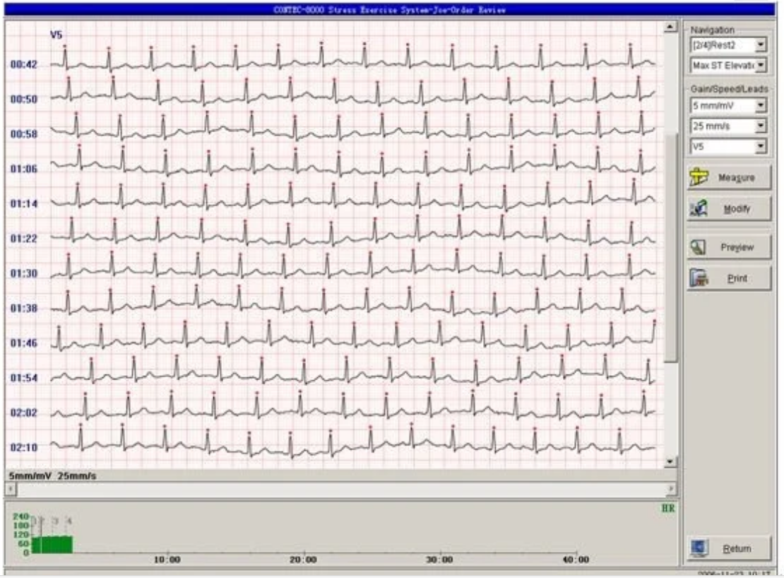 RR8000S Wireless Stress ECG/EKG Analysis System,Exercise stress ECG Test